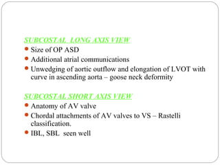 AV septal defects (AVCD) | PPT