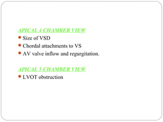 AV septal defects (AVCD) | PPT