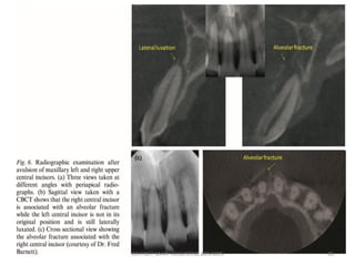 DR.TINET MARY AUGUSTINE.BDS.MDS 26
 