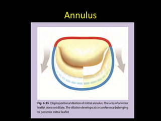 Atrioventricular valves (Mitral and Tricuspid) - Surgical anatomy | PPTX