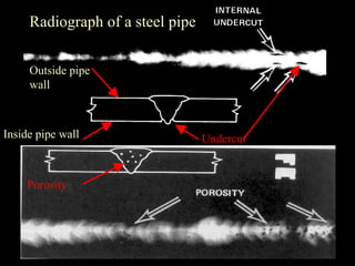 Radiograph of a steel pipe
Outside pipe
wall
Inside pipe wall Undercut
Porosity
 
