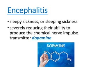 Encephalitis
•sleepy sickness, or sleeping sickness
•severely reducing their ability to
produce the chemical nerve impulse
transmitter dopamine
 