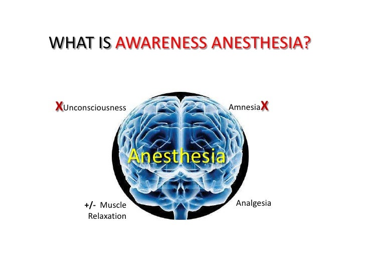 Dissertation awareness under general anesthesia