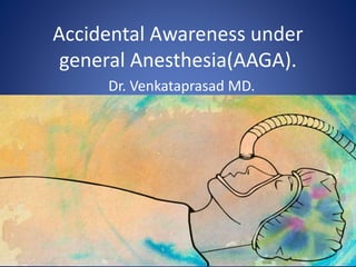 Accidental Awareness under
general Anesthesia(AAGA).
Dr. Venkataprasad MD.
 