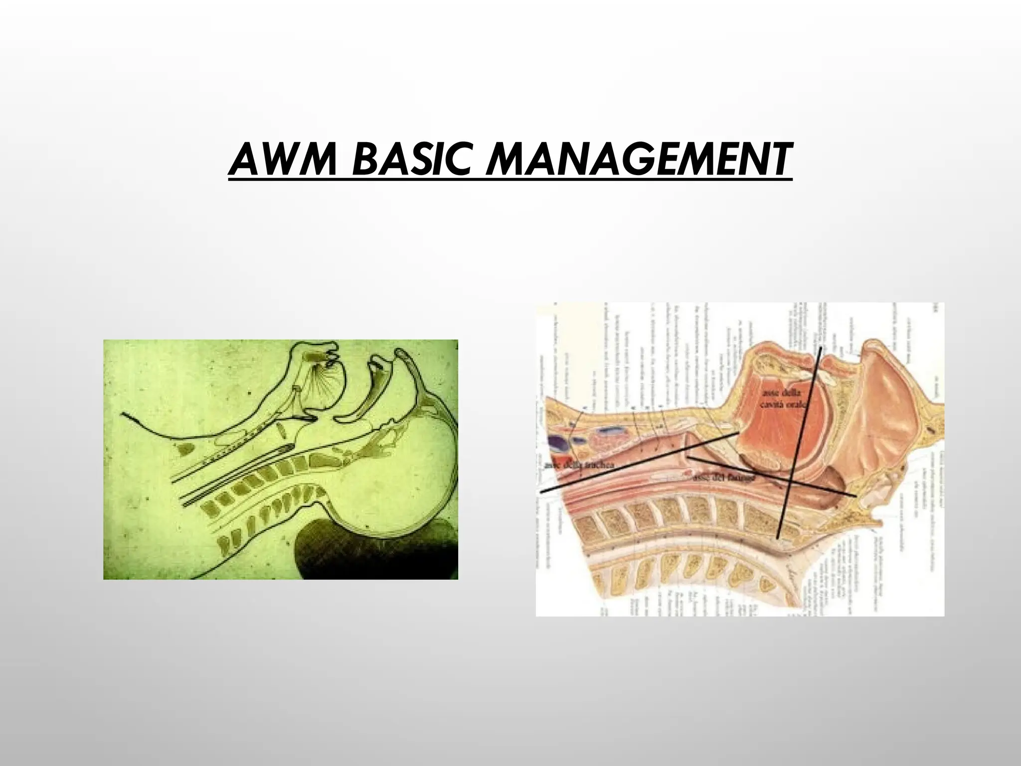 AWM BASIC MANAGEMENT
 