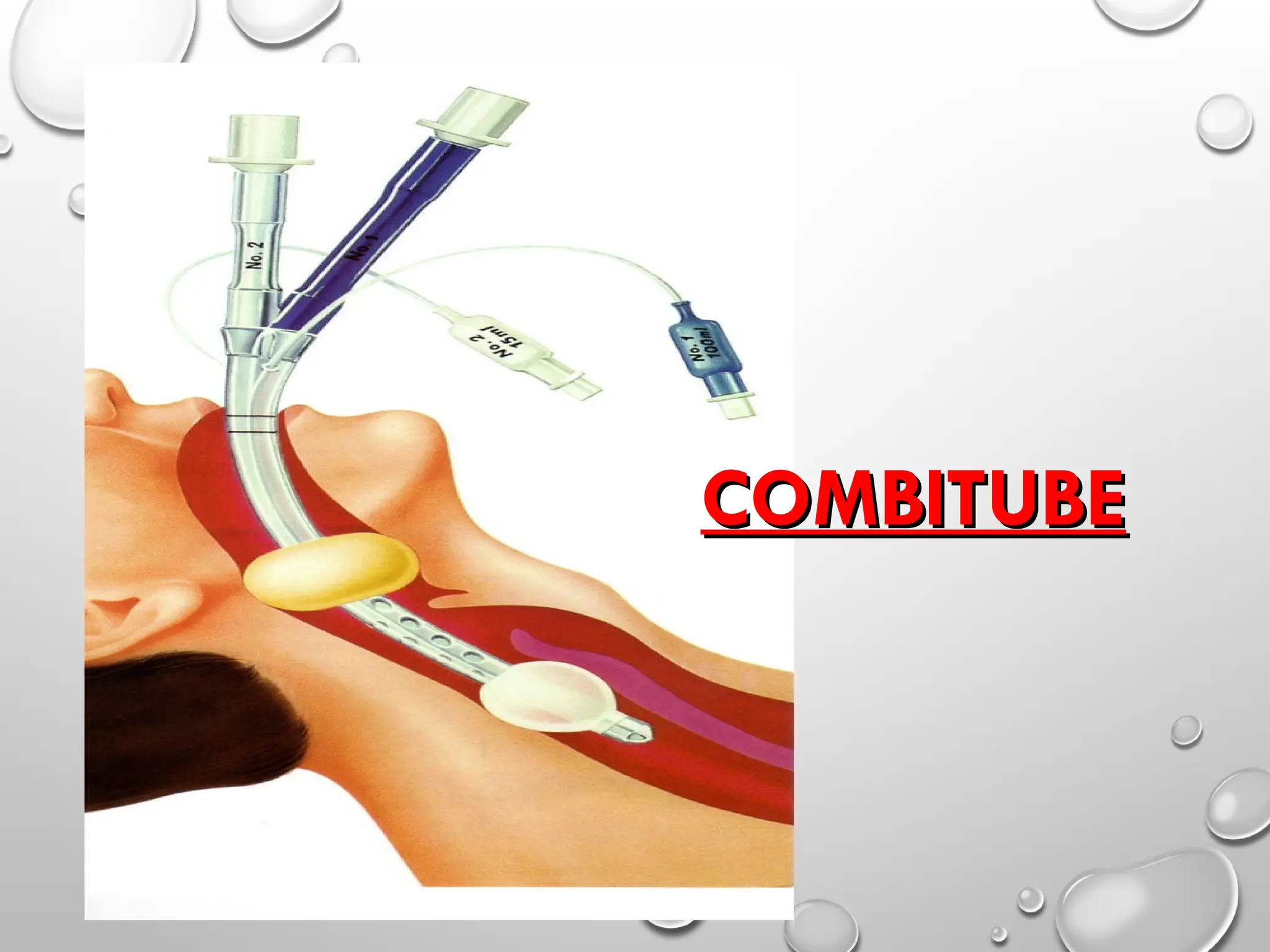 COMBITUBE
COMBITUBE
 
