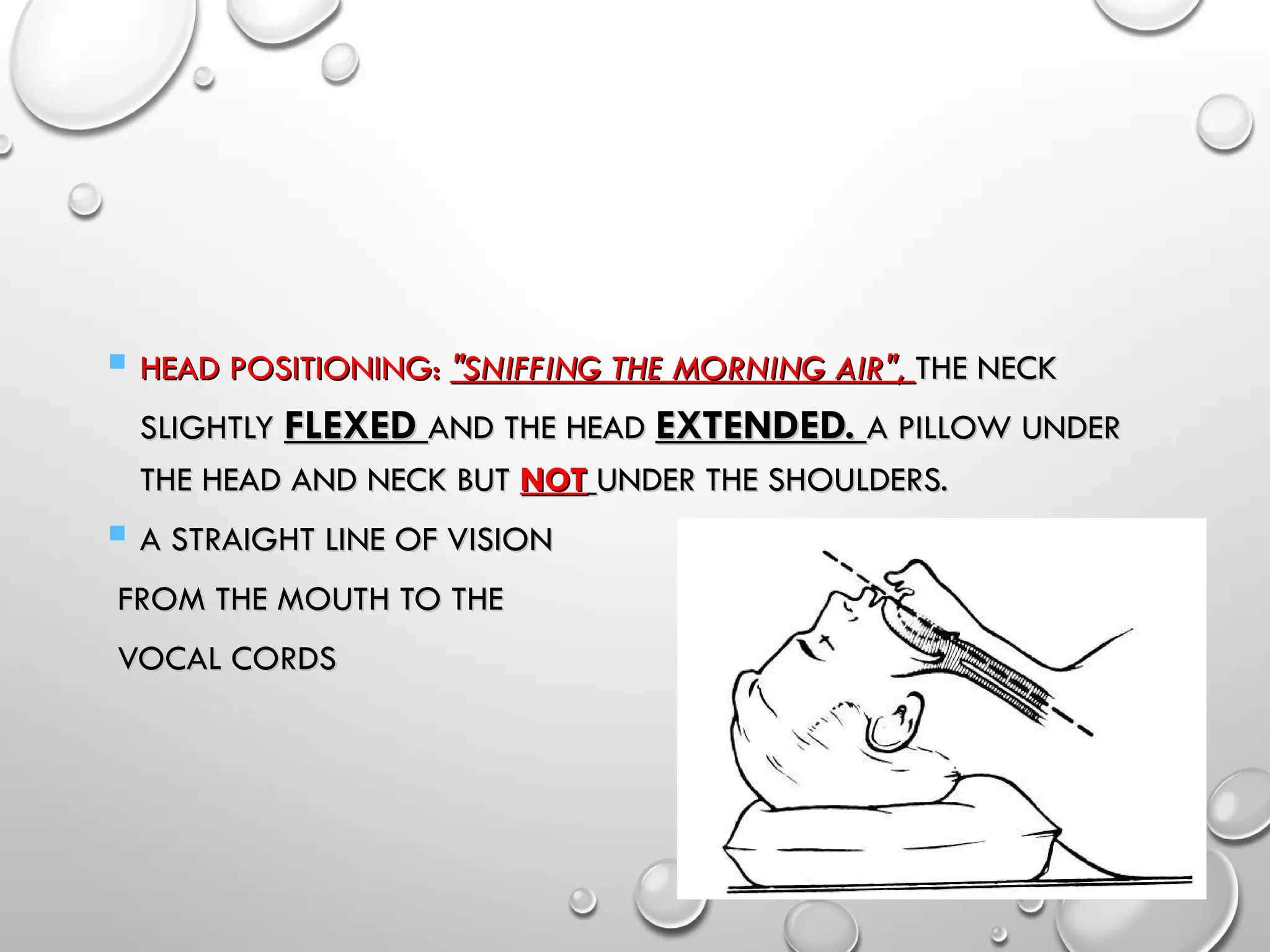  HEAD POSITIONING:
HEAD POSITIONING: "SNIFFING THE MORNING AIR",
"SNIFFING THE MORNING AIR", THE NECK
THE NECK
SLIGHTLY
SLIGHTLY FLEXED
FLEXED AND THE HEAD
AND THE HEAD EXTENDED.
EXTENDED. A PILLOW UNDER
A PILLOW UNDER
THE HEAD AND NECK BUT
THE HEAD AND NECK BUT NOT
NOT UNDER THE SHOULDERS.
UNDER THE SHOULDERS.
 A STRAIGHT LINE OF VISION
A STRAIGHT LINE OF VISION
FROM THE MOUTH TO THE
FROM THE MOUTH TO THE
VOCAL CORDS
VOCAL CORDS
 