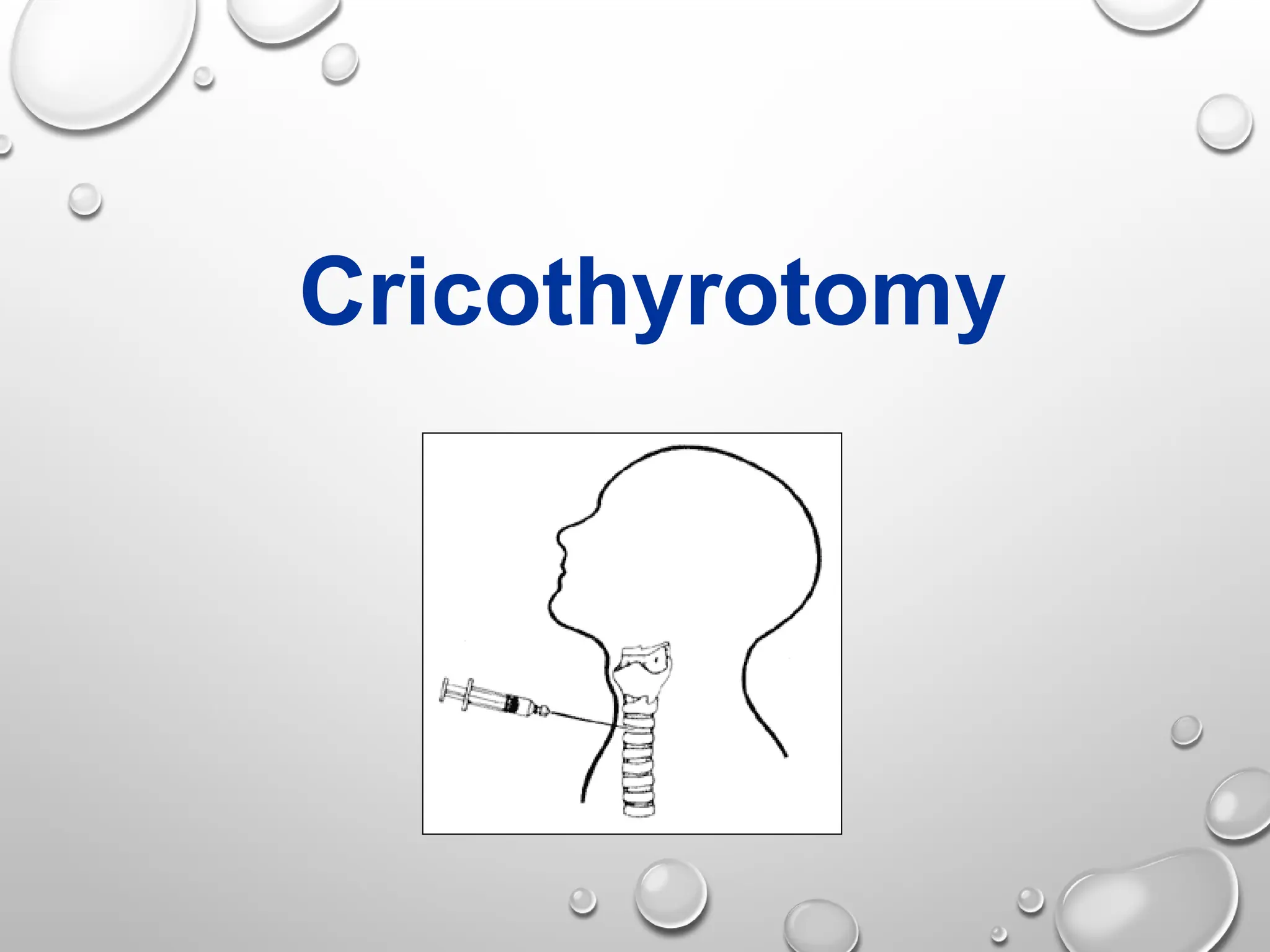 Cricothyrotomy
 
