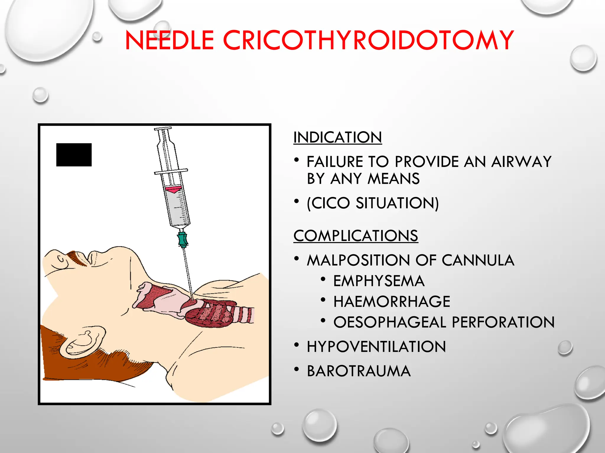 NEEDLE CRICOTHYROIDOTOMY
INDICATION
• FAILURE TO PROVIDE AN AIRWAY
BY ANY MEANS
• (CICO SITUATION)
COMPLICATIONS
• MALPOSITION OF CANNULA
• EMPHYSEMA
• HAEMORRHAGE
• OESOPHAGEAL PERFORATION
• HYPOVENTILATION
• BAROTRAUMA
 
