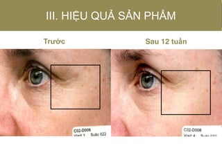 Trước Sau 12 tuần
III. HIỆU QUẢ SẢN PHẨM
 