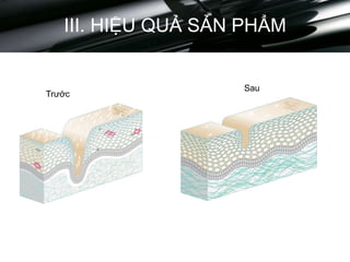 III. HIỆU QUẢ SẢN PHẨM
Trước
Sau
 
