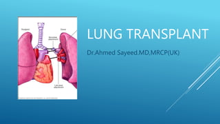 LUNG TRANSPLANT
Dr.Ahmed Sayeed.MD,MRCP(UK)
 