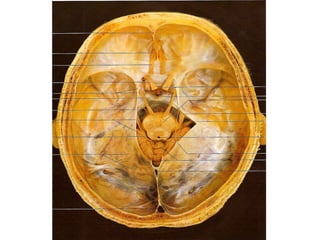 Axial skeleton   cranial images