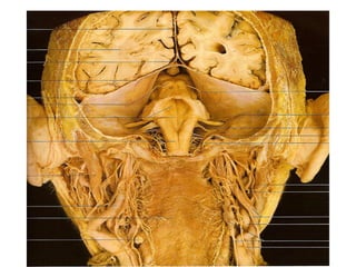 Axial skeleton   cranial images