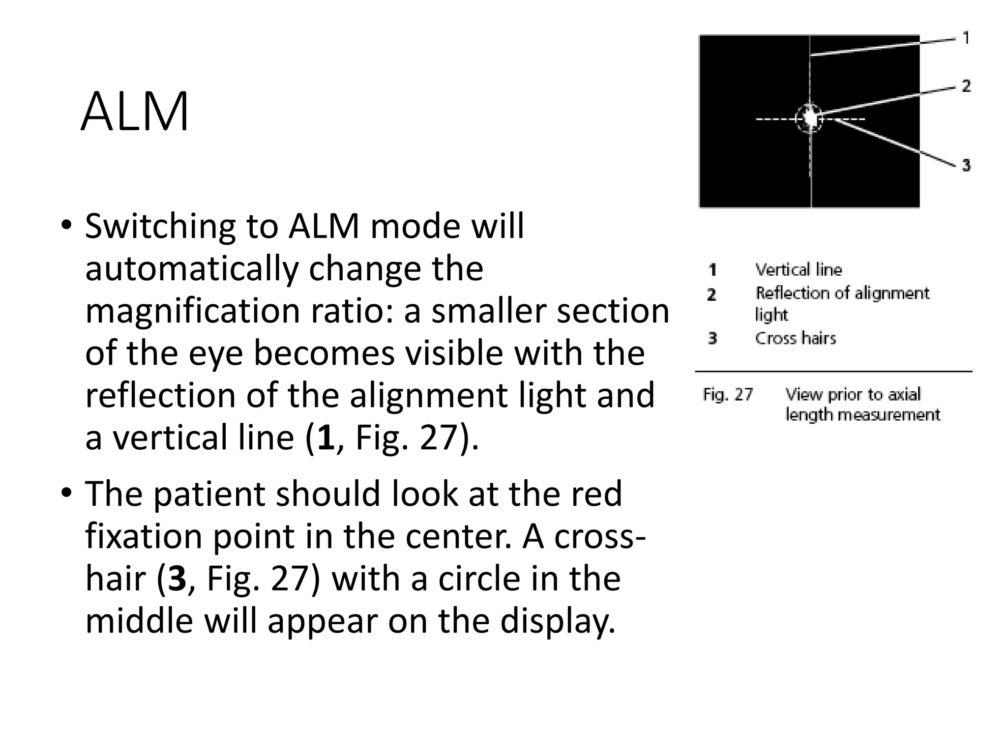 ALM
• Switching to ALM mode will
automatically change the
magnification ratio: a smaller section
of the eye becomes visible with the
reflection of the alignment light and
a vertical line (1, Fig. 27).
• The patient should look at the red
fixation point in the center. A cross-
hair (3, Fig. 27) with a circle in the
middle will appear on the display.
 