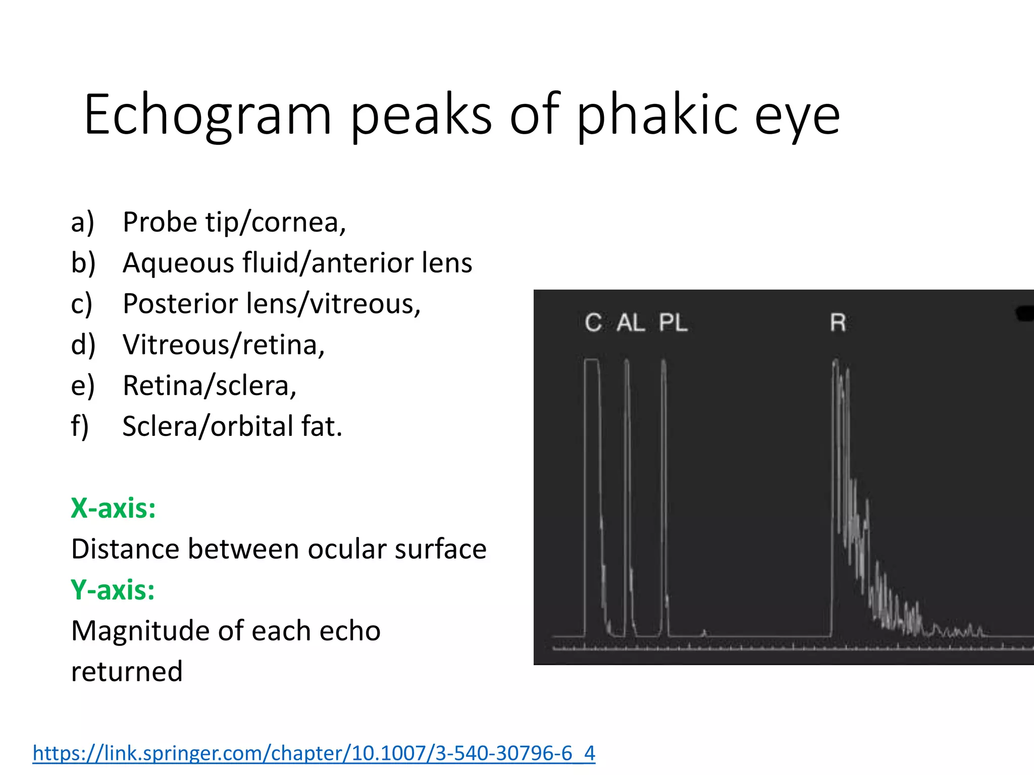 Echogram peaks of phakic eye
a) Probe tip/cornea,
b) Aqueous fluid/anterior lens
c) Posterior lens/vitreous,
d) Vitreous/retina,
e) Retina/sclera,
f) Sclera/orbital fat.
X-axis:
Distance between ocular surface
Y-axis:
Magnitude of each echo
returned
https://link.springer.com/chapter/10.1007/3-540-30796-6_4
 