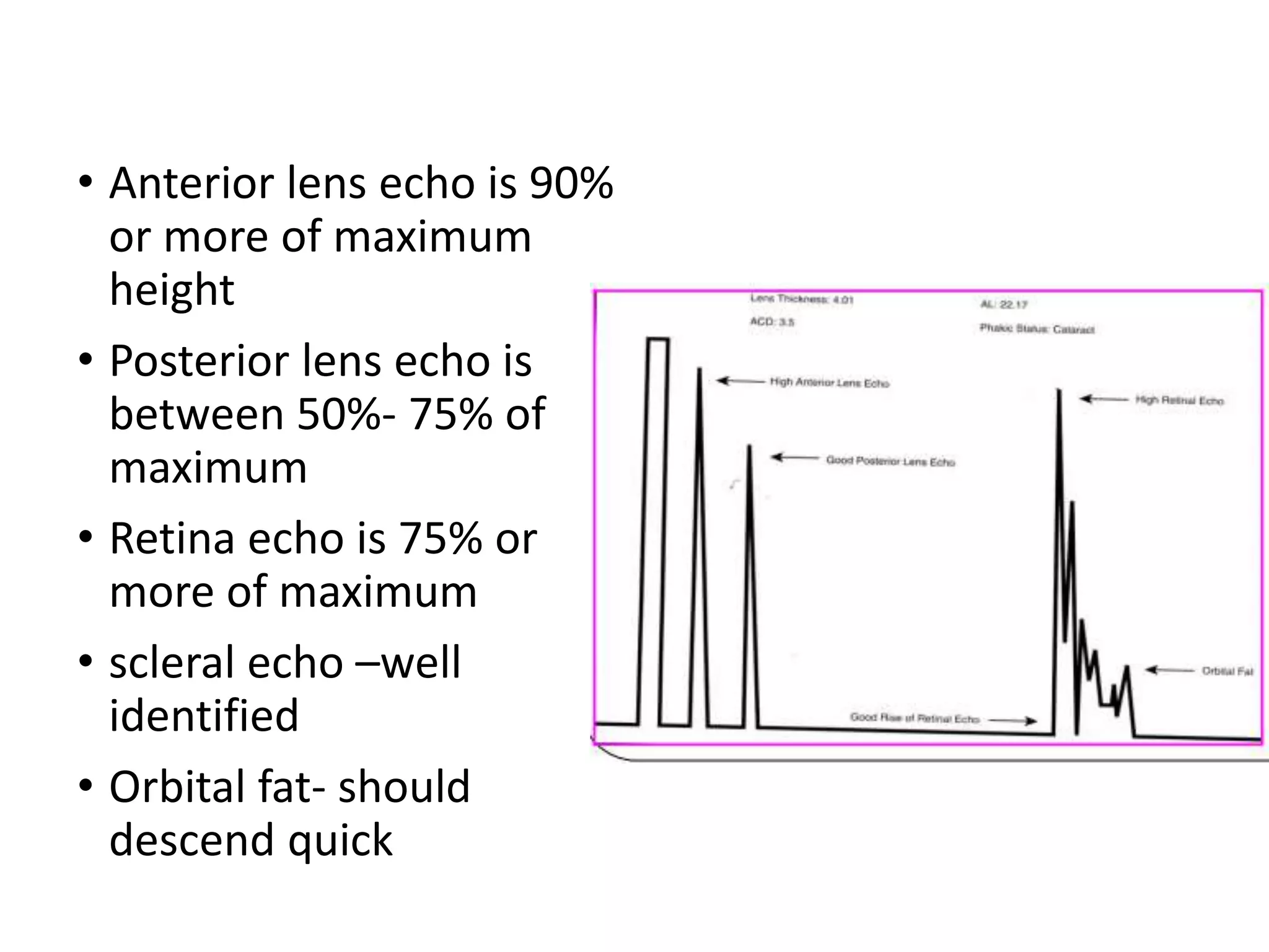 • Anterior lens echo is 90%
or more of maximum
height
• Posterior lens echo is
between 50%- 75% of
maximum
• Retina echo is 75% or
more of maximum
• scleral echo –well
identified
• Orbital fat- should
descend quick
 