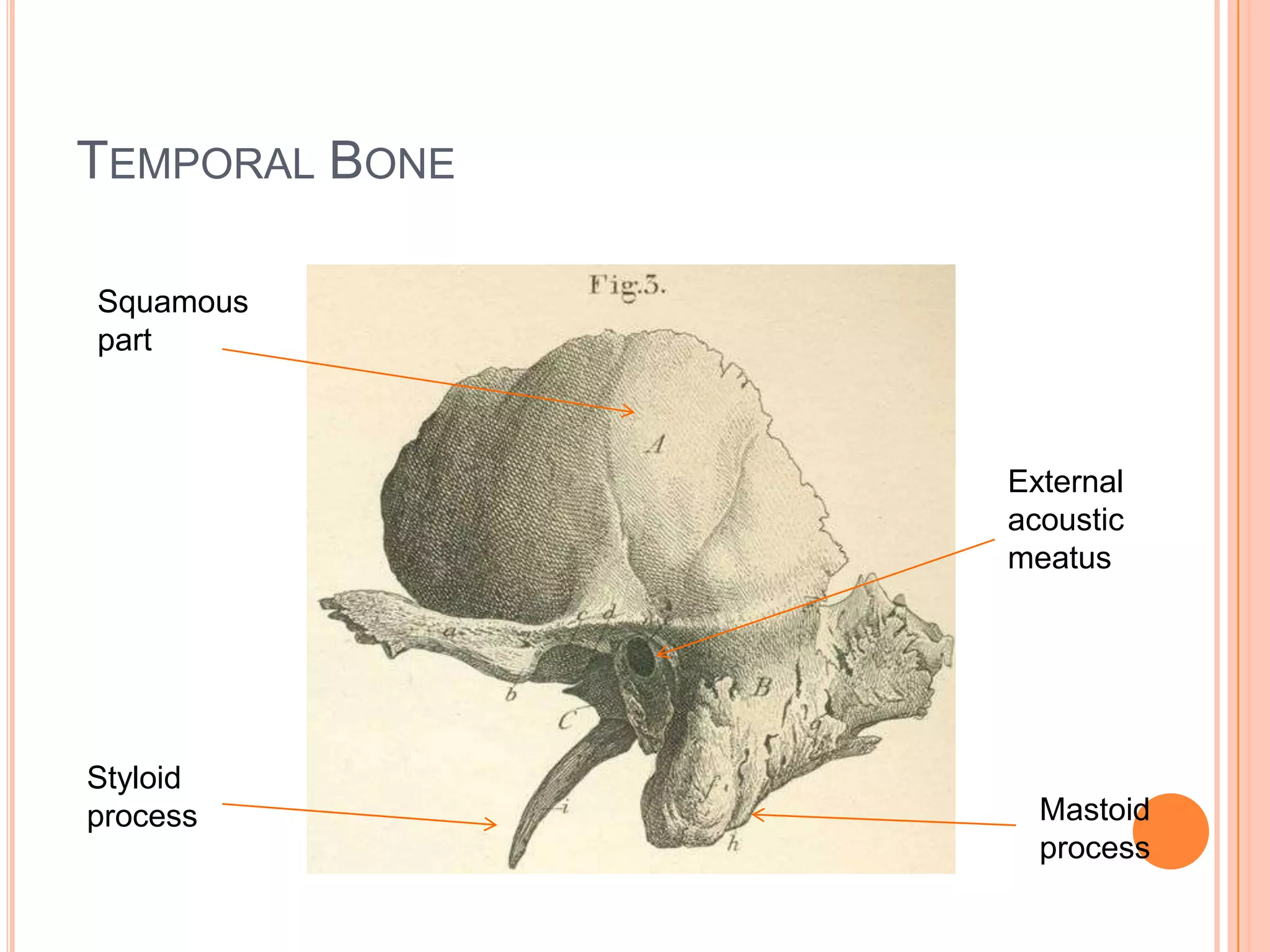 Temporal BoneSquamous partExternal acoustic meatusStyloid processMastoid process