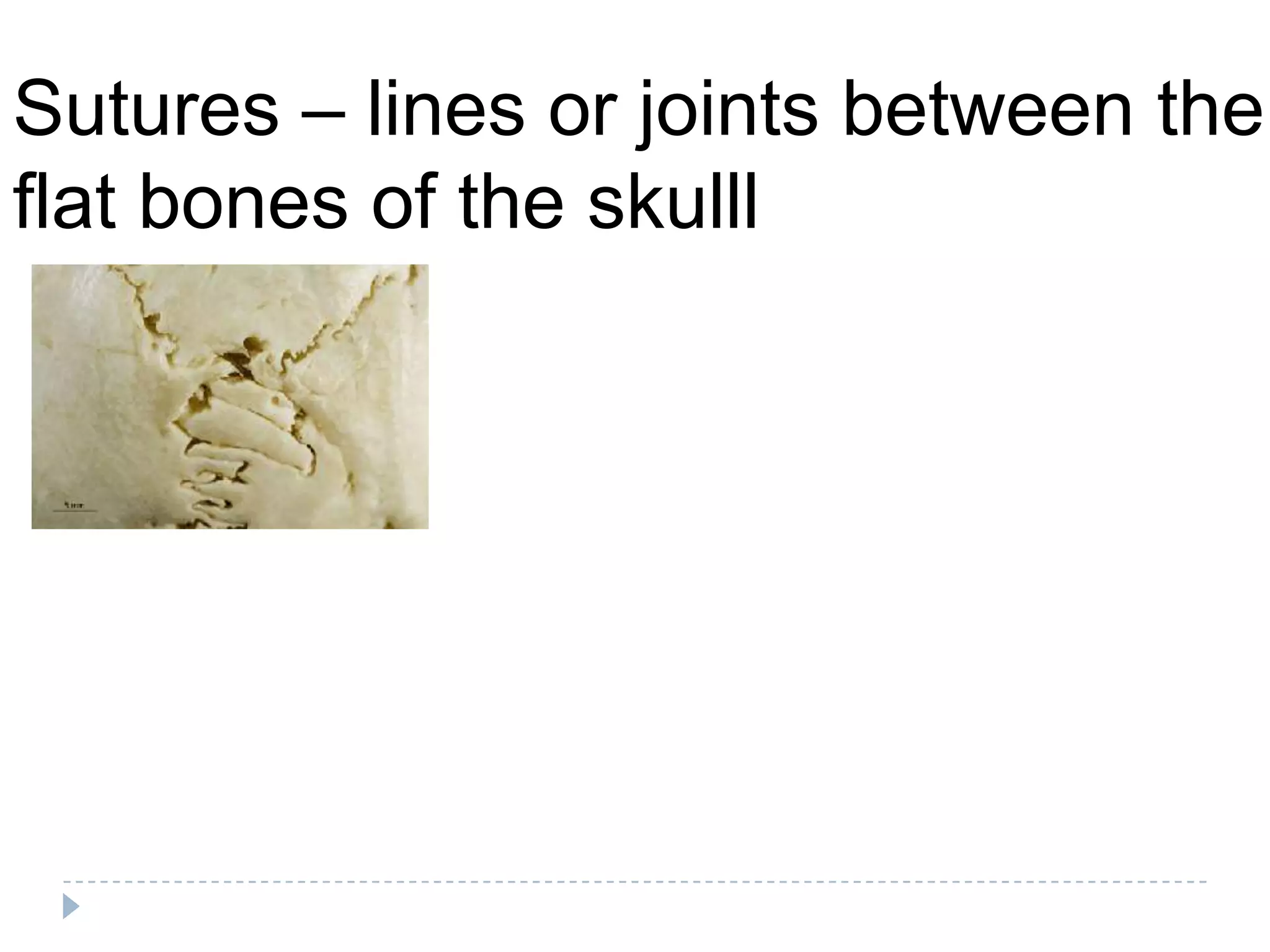 Sutures – lines or joints between the
flat bones of the skulll
 