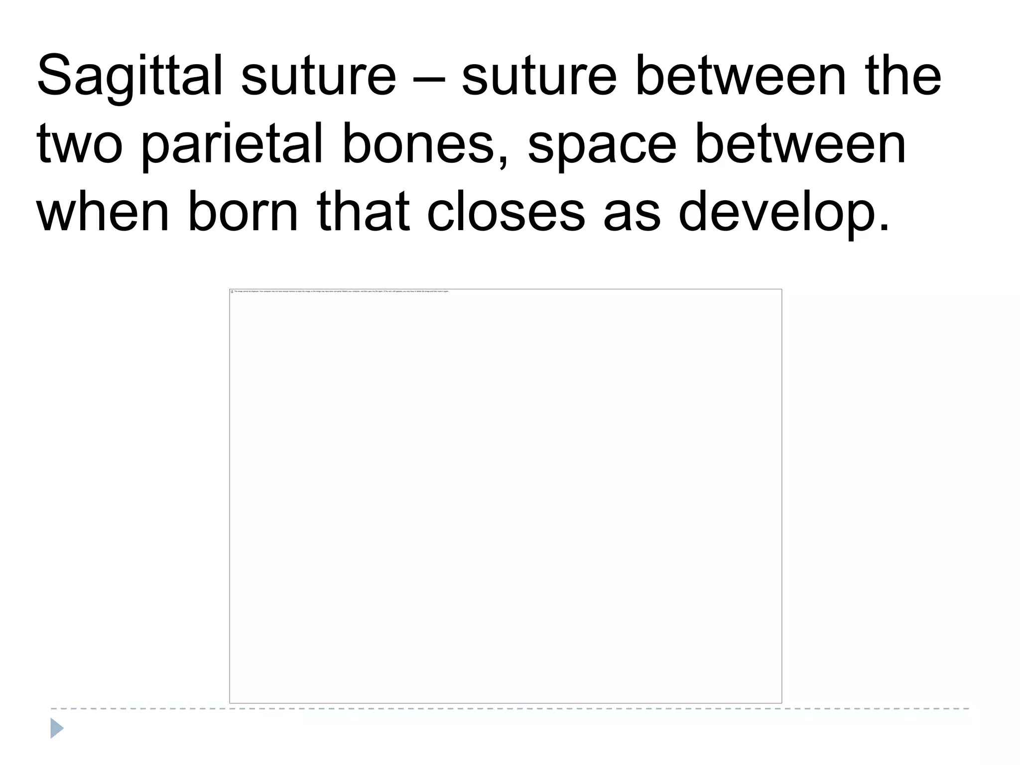 Sagittal suture – suture between the
two parietal bones, space between
when born that closes as develop.
 