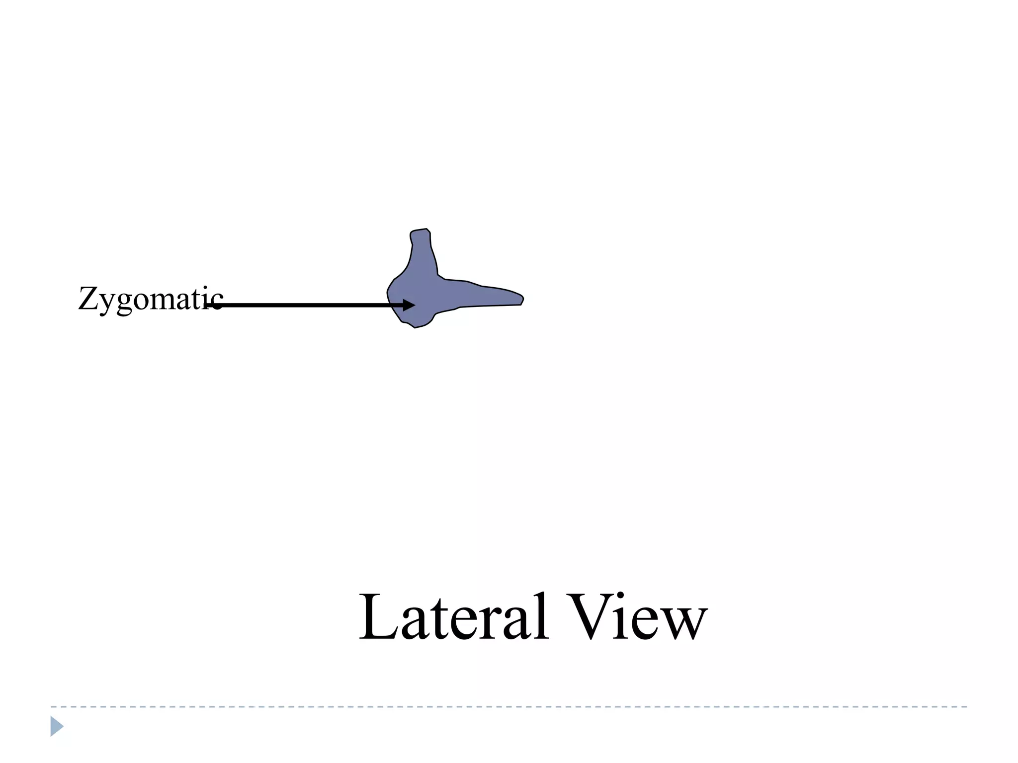 Zygomatic




            Lateral View
 