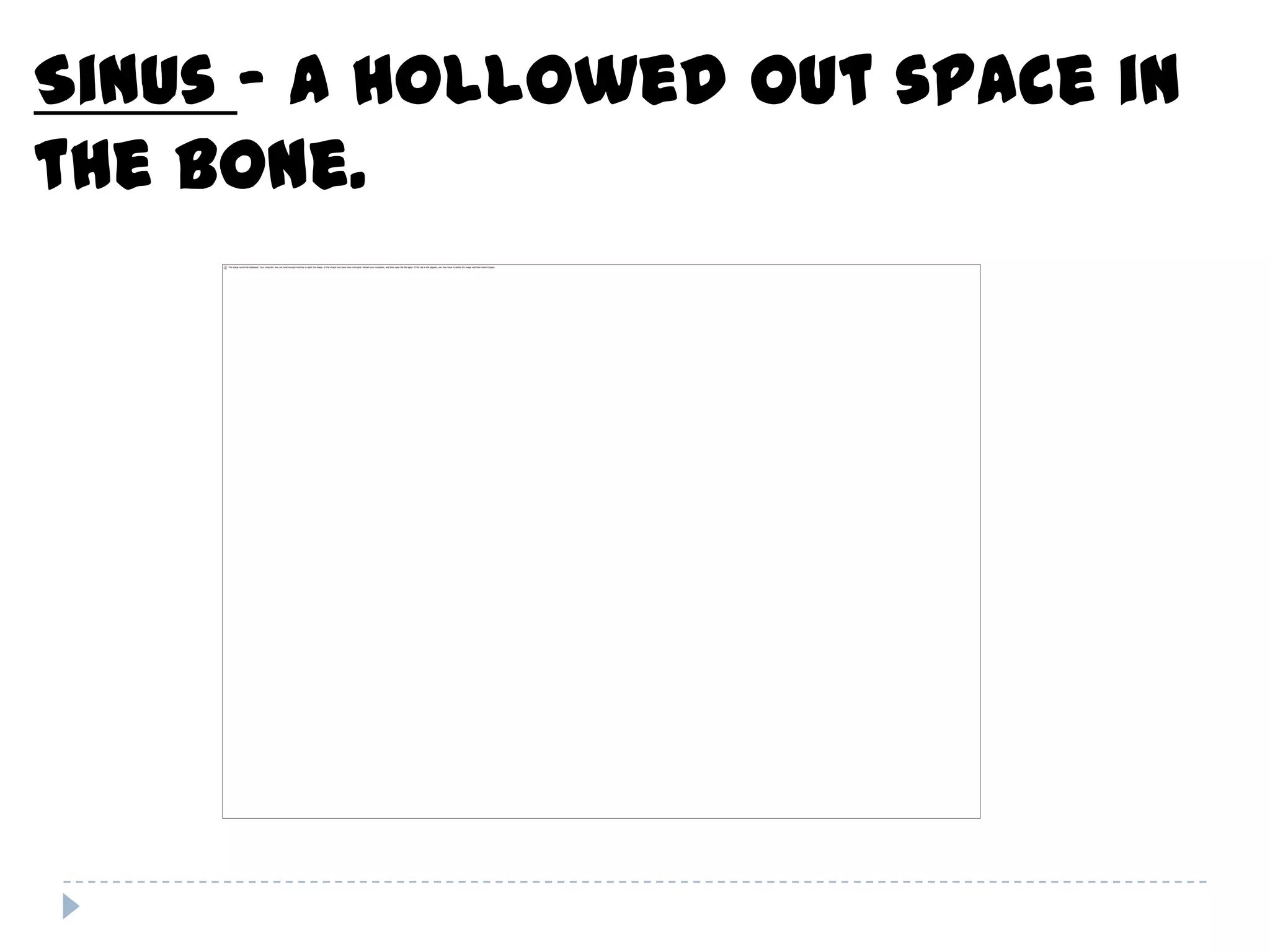 Sinus – a hollowed out space in
the bone.
 