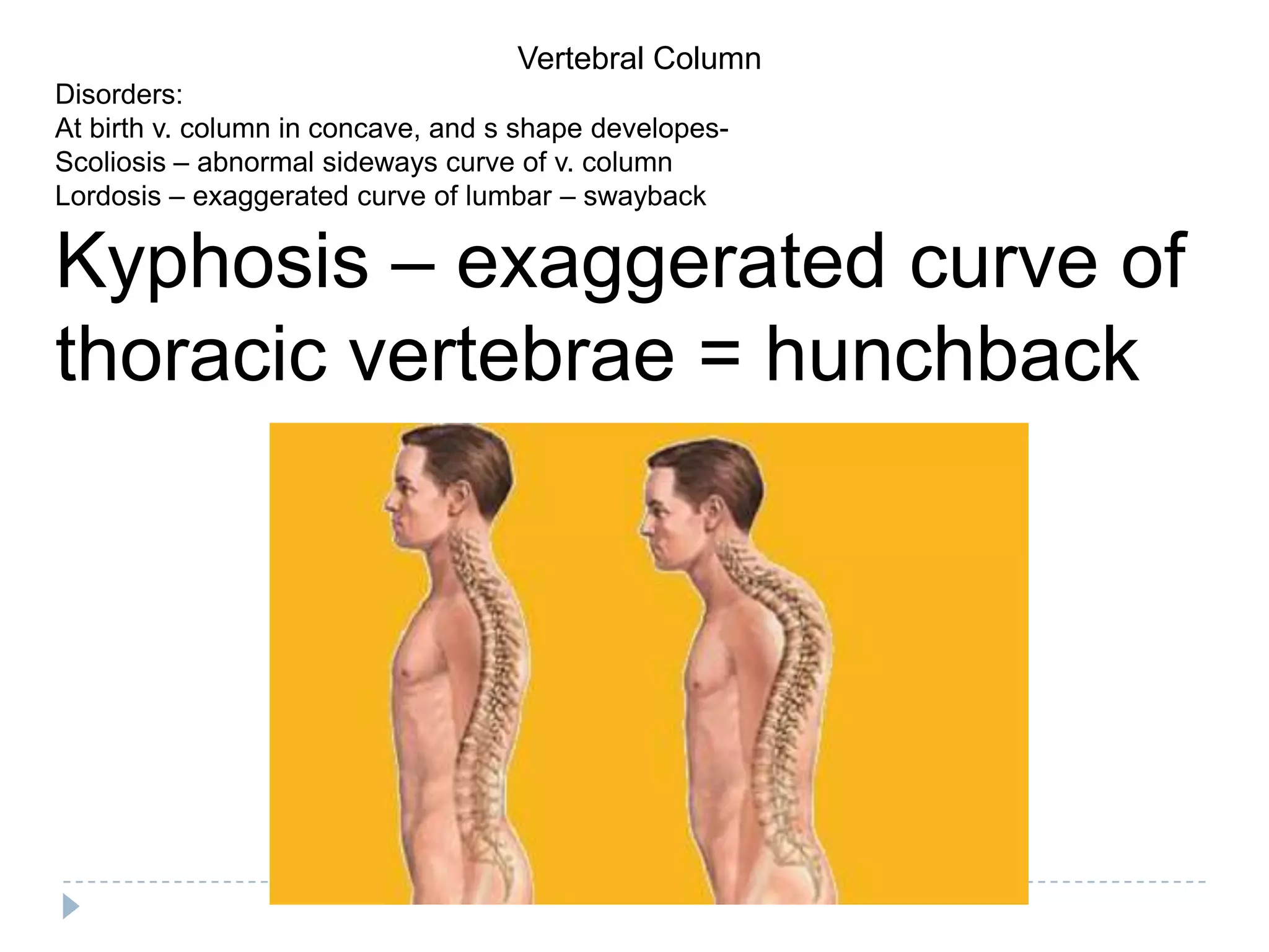 Vertebral Column
Disorders:
At birth v. column in concave, and s shape developes-
Scoliosis – abnormal sideways curve of v. column
Lordosis – exaggerated curve of lumbar – swayback

Kyphosis – exaggerated curve of
thoracic vertebrae = hunchback
 