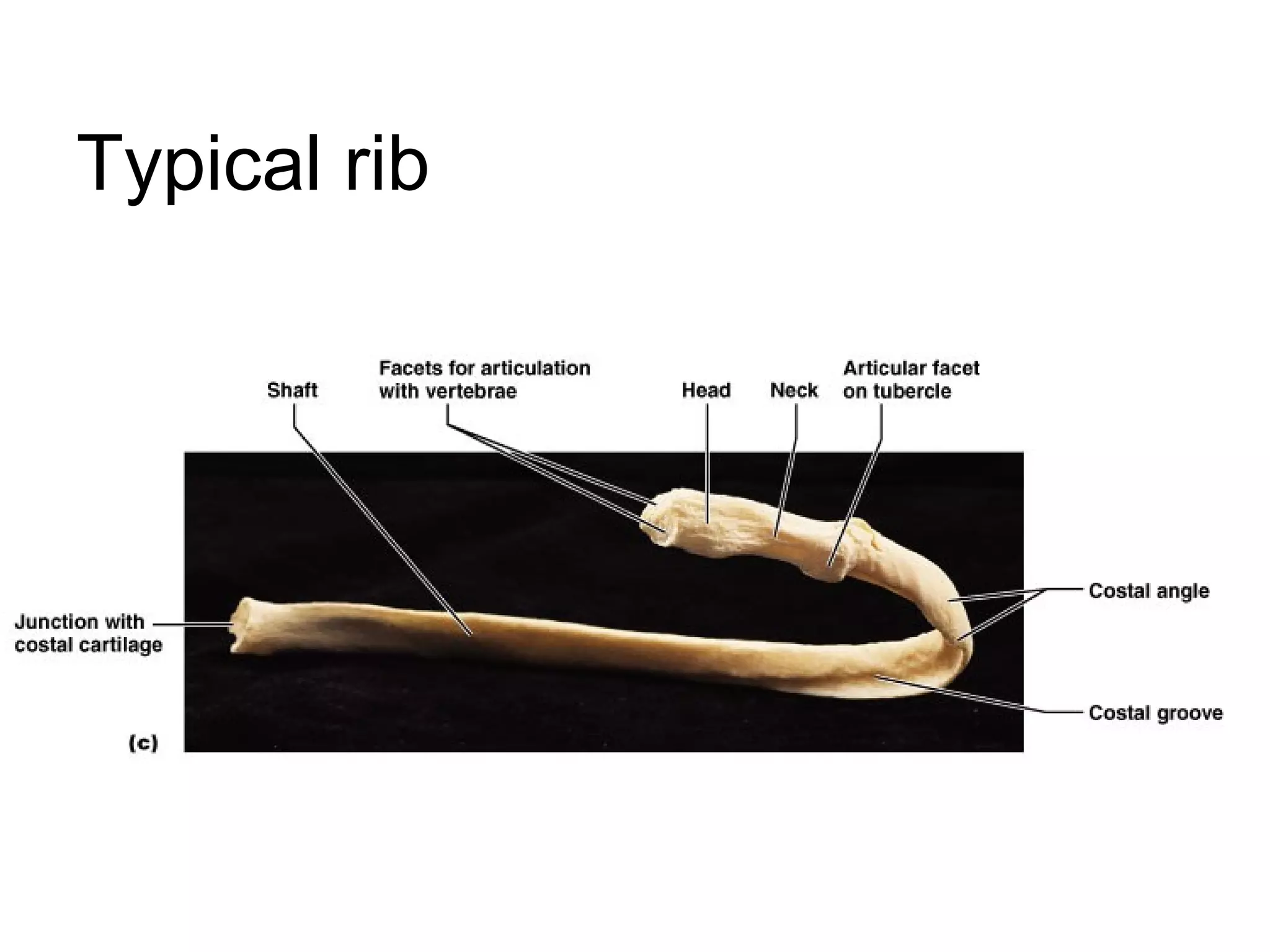 Typical rib
 