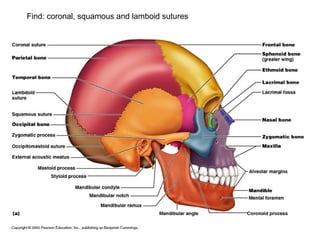 Find: coronal, squamous and lamboid sutures
 