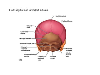 Find: sagittal and lambdoid sutures
 