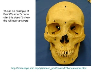 http://homepage.smc.edu/wissmann_paul/bones/EBbonestutorial.html
This is an example of
Prof Wissman’s bone
site; this doesn’t show
the roll-over answers
 