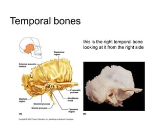 Temporal bones
this is the right temporal bone
looking at it from the right side
 