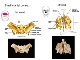 Sphenoid
Ethmoid
Small cranial bones…
 