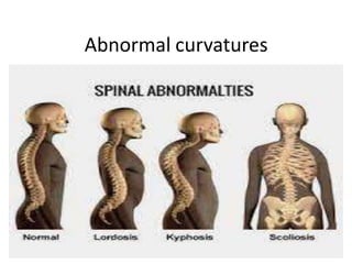 Abnormal curvatures
 