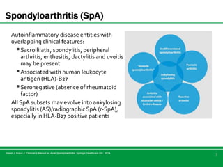 Axial sp a and its management | PPTX