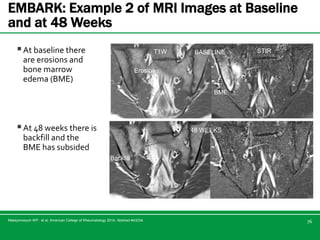 Axial sp a and its management | PPTX
