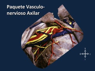 Paquete Vasculo-
nervioso Axilar




                       S

                   D       I

                       I
 