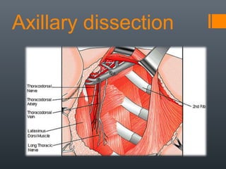 Axillary dissection
 