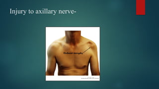 Comprehensive Overview of Axilla Anatomy and Brachial Plexus Injuries ...