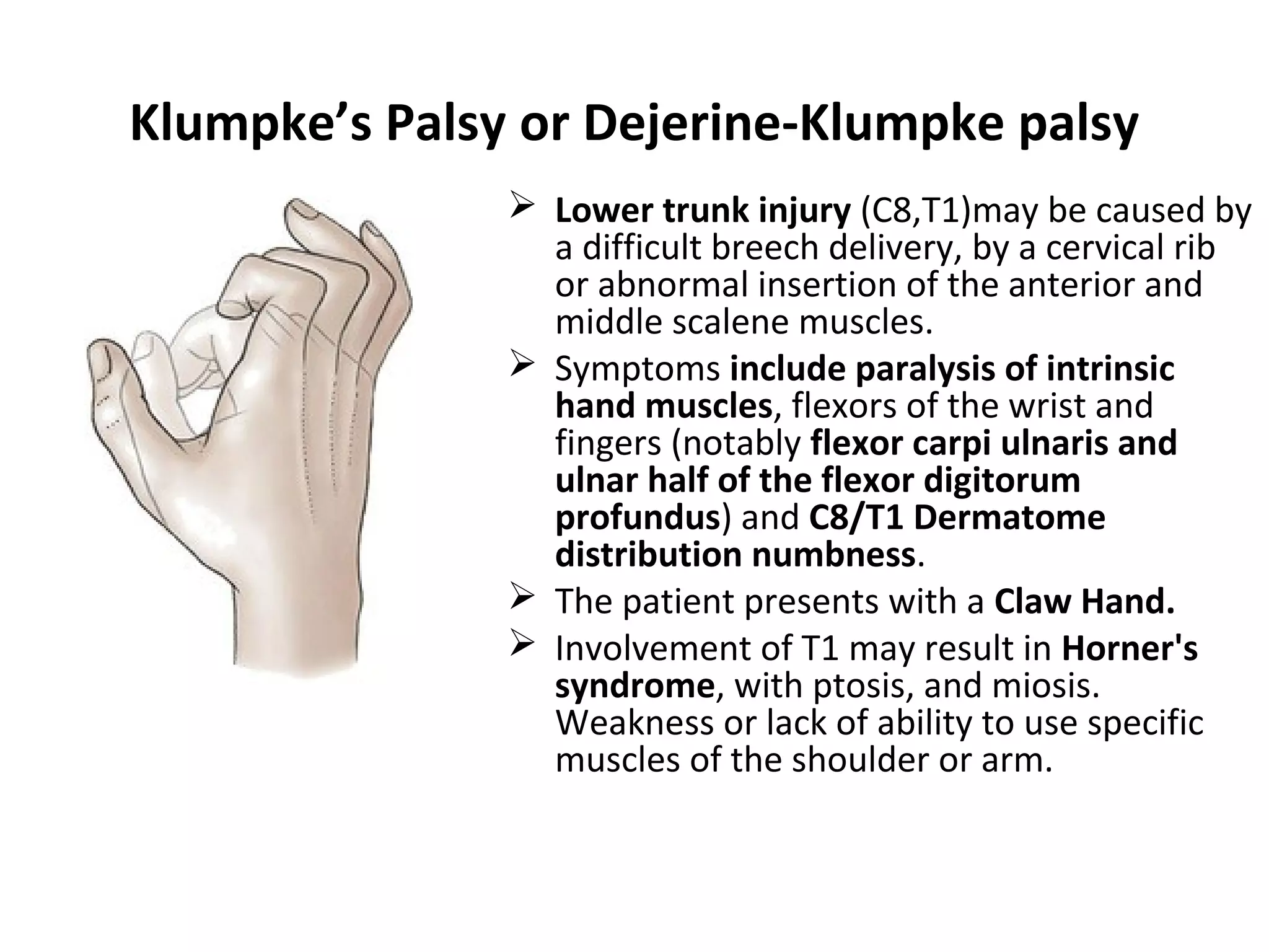 Klumpke’s Palsy or Dejerine-Klumpke palsy
 Lower trunk injury (C8,T1)may be caused by
a difficult breech delivery, by a cervical rib
or abnormal insertion of the anterior and
middle scalene muscles.
 Symptoms include paralysis of intrinsic
hand muscles, flexors of the wrist and
fingers (notably flexor carpi ulnaris and
ulnar half of the flexor digitorum
profundus) and C8/T1 Dermatome
distribution numbness.
 The patient presents with a Claw Hand.
 Involvement of T1 may result in Horner's
syndrome, with ptosis, and miosis.
Weakness or lack of ability to use specific
muscles of the shoulder or arm.
 
