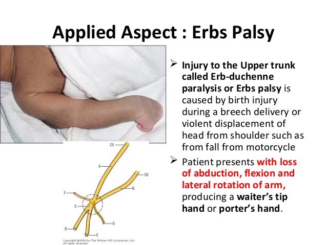 Axilla & brachial plexus