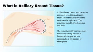 Axillary Breast Tissue Causes, Symptoms, and Treatment.pdf