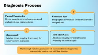 Axillary Breast Tissue Causes, Symptoms, and Treatment.pdf