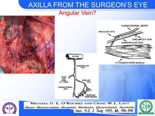 axillary dissection-current Place in breast cancer staging.pptx