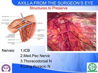 axillary dissection-current Place in breast cancer staging.pptx