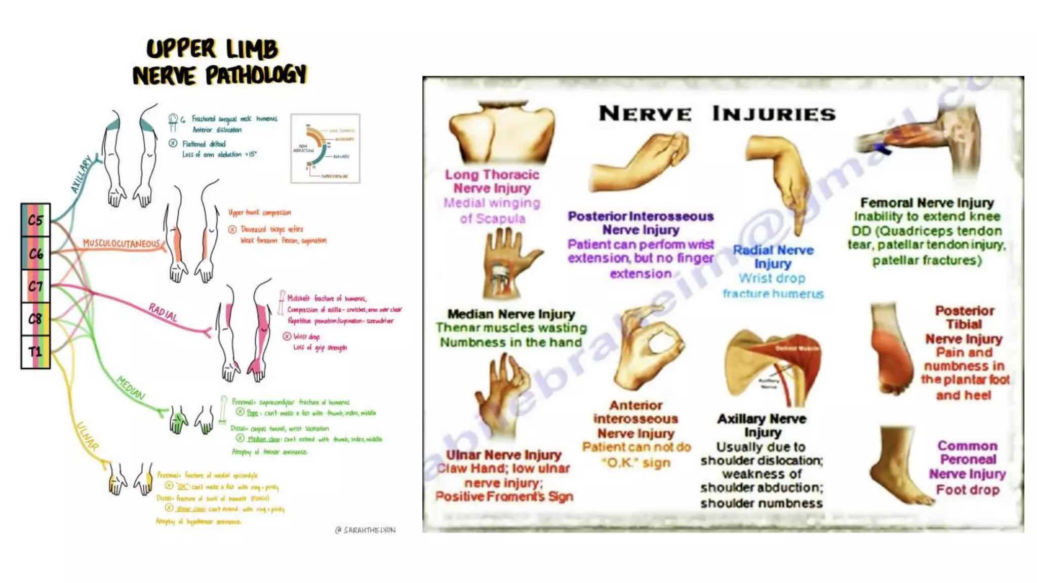 Axillary, Musculocutaneous & Radial Nerve.pptx