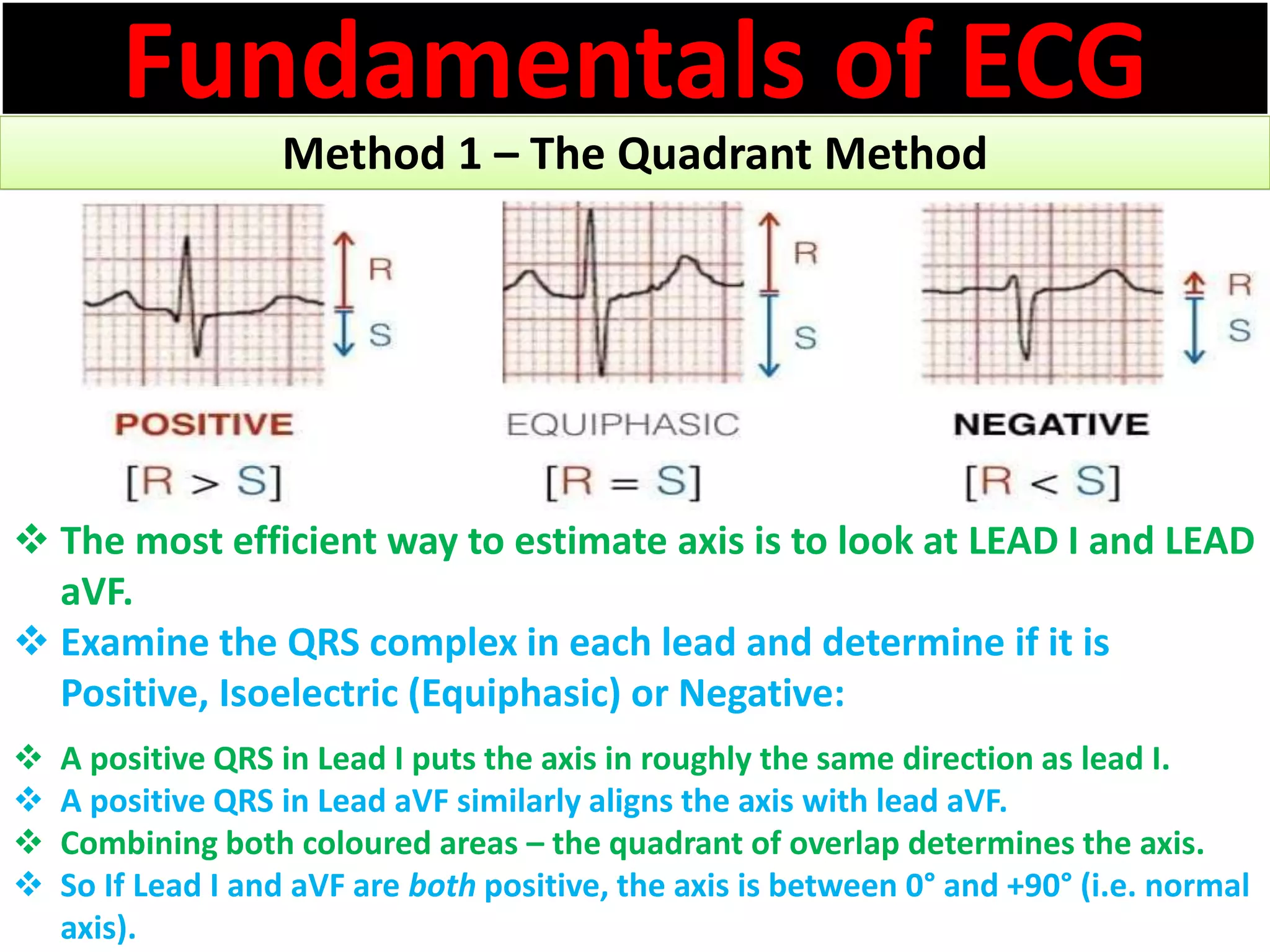 Fundamentals of ECG
Method 1 – The Quadrant Method
 The most efficient way to estimate axis is to look at LEAD I and LEAD
aVF.
 Examine the QRS complex in each lead and determine if it is
Positive, Isoelectric (Equiphasic) or Negative:
 A positive QRS in Lead I puts the axis in roughly the same direction as lead I.
 A positive QRS in Lead aVF similarly aligns the axis with lead aVF.
 Combining both coloured areas – the quadrant of overlap determines the axis.
 So If Lead I and aVF are both positive, the axis is between 0° and +90° (i.e. normal
axis).
 