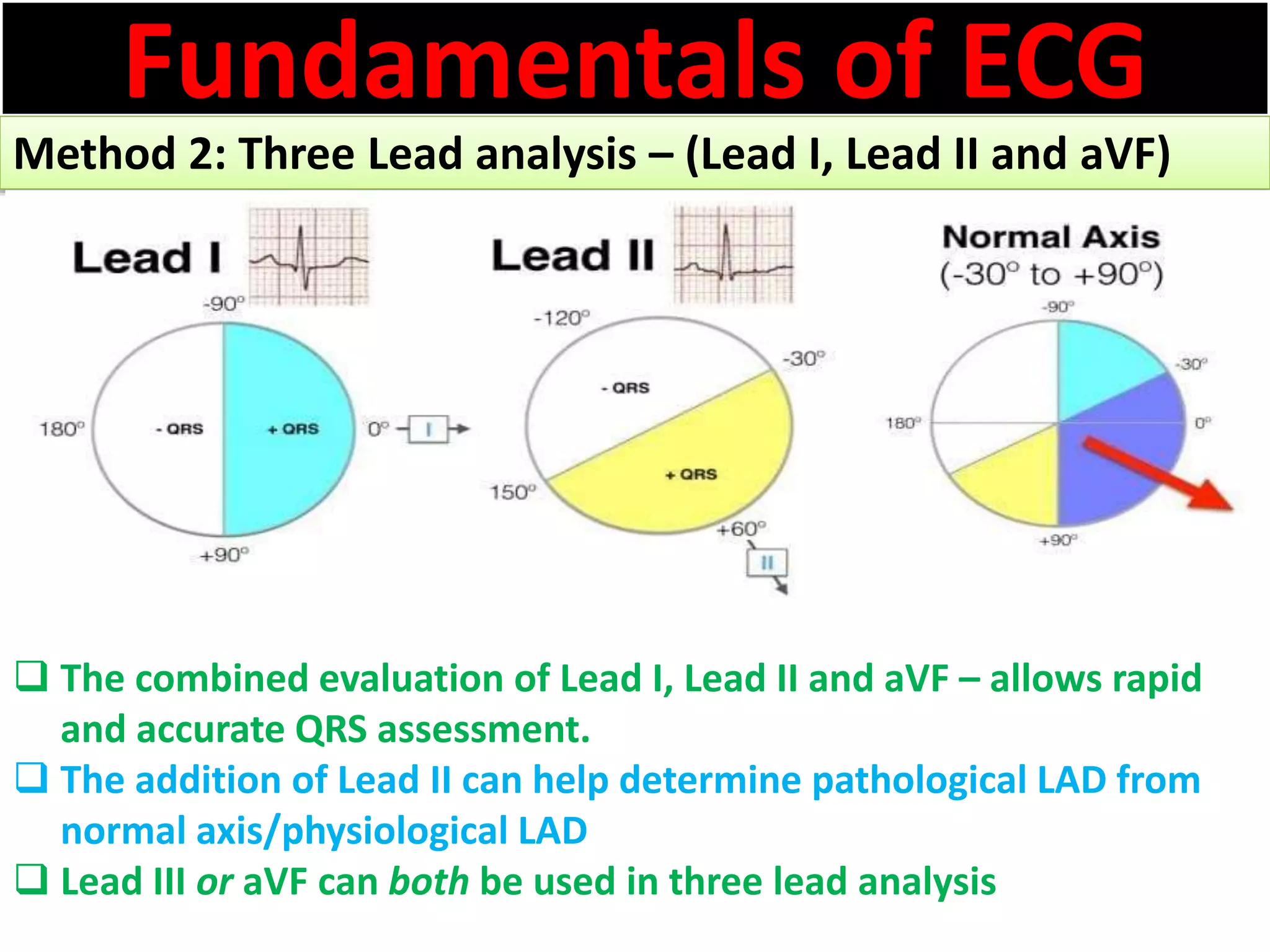 Fundamentals of ECG
Method 2: Three Lead analysis – (Lead I, Lead II and aVF)
 The combined evaluation of Lead I, Lead II and aVF – allows rapid
and accurate QRS assessment.
 The addition of Lead II can help determine pathological LAD from
normal axis/physiological LAD
 Lead III or aVF can both be used in three lead analysis
 