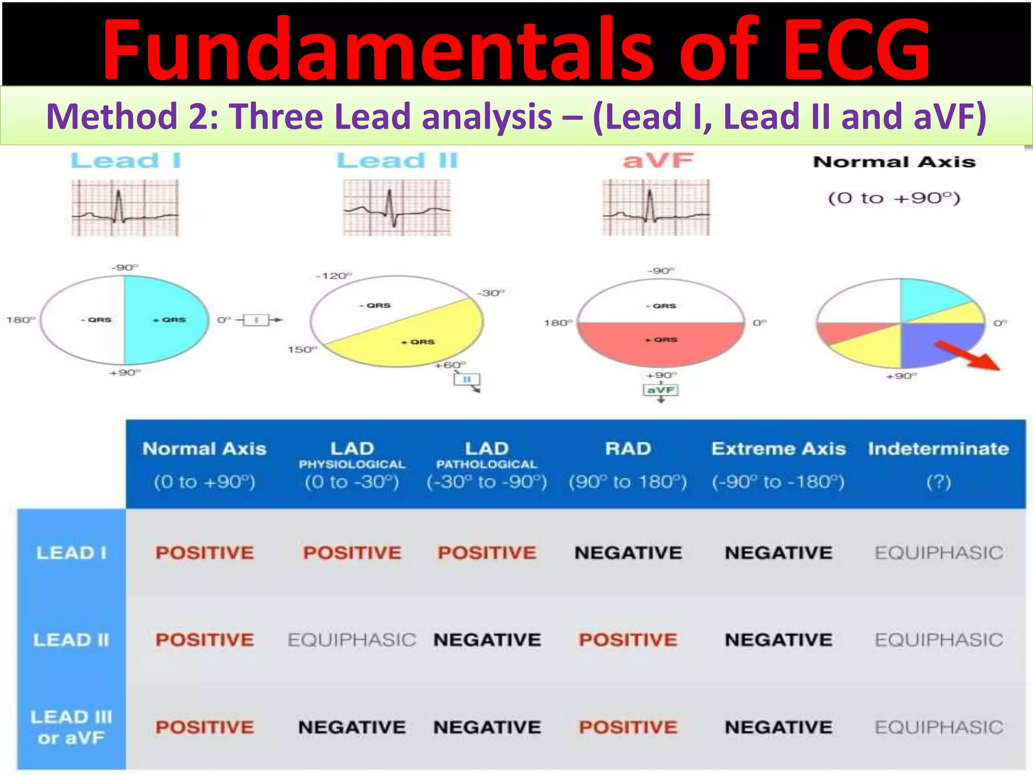 Fundamentals of ECG
Method 2: Three Lead analysis – (Lead I, Lead II and aVF)
 