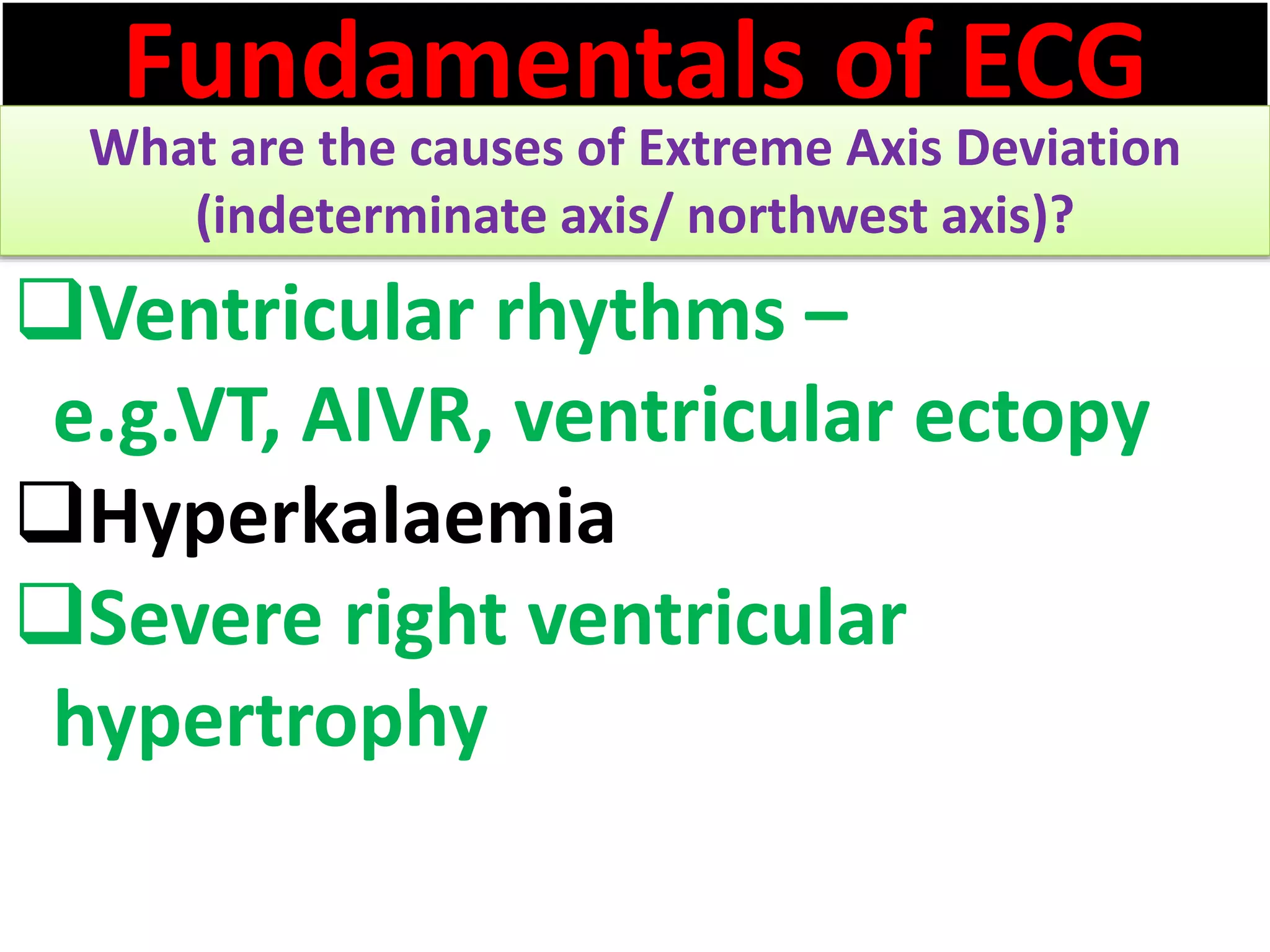 Fundamentals of ECG
What are the causes of Extreme Axis Deviation
(indeterminate axis/ northwest axis)?
Ventricular rhythms –
e.g.VT, AIVR, ventricular ectopy
Hyperkalaemia
Severe right ventricular
hypertrophy
 